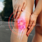 Rebound-Fitness-rehab-Physical-Therapy-Clinic-Northbrook-IL-knee-pain-relief