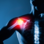 Rebound-Fitness-rehab-Physical-Therapy-Clinic-Northbrook-IL-shoulder-pain-relief